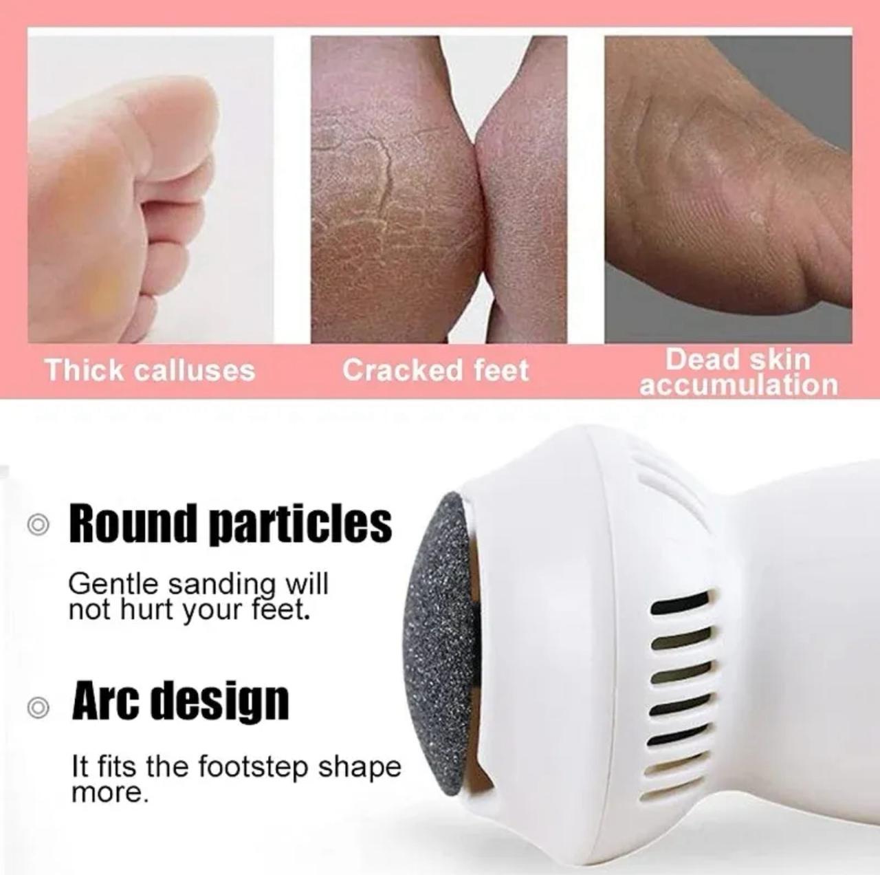 Foot Grinder